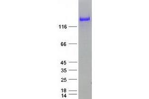 Validation with Western Blot
