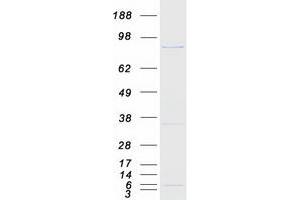 Validation with Western Blot
