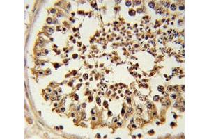 Formalin-fixed and paraffin-embedded human testis tissue tested with EZH2 antibody