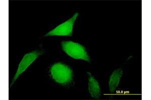 Immunofluorescence of purified MaxPab antibody to PSMD14 on HeLa cell.