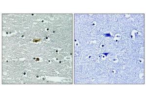 Immunohistochemical analysis of paraffin-embedded human brain tissue using STK39 (Phospho-Ser309) antibody (left)or the same antibody preincubated with blocking peptide (right).