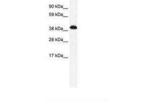 Image no. 1 for anti-Zinc Finger Protein 568 (ZNF568) (AA 143-192) antibody (ABIN6735990) (ZNF568 anticorps  (AA 143-192))