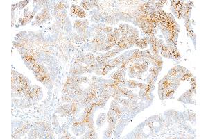 Immunohistochemistry (IHC) image for anti-Syndecan 1 (SDC1) (AA 23-251) antibody (ABIN7795741)