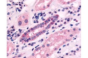 Anti-5HT1F Receptor antibody IHC of human kidney, renal tubules.