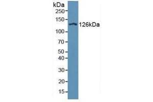 Western blot analysis of Human Serum. (ITGAD anticorps  (AA 879-1099))