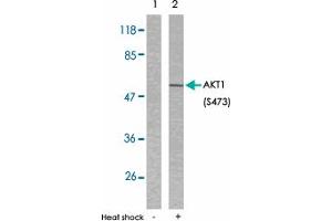 Western blot analysis of extracts from HeLa cells untreated or treated with heat shock using AKT1 (phospho S473) polyclonal antibody . (AKT1 anticorps  (pSer473))