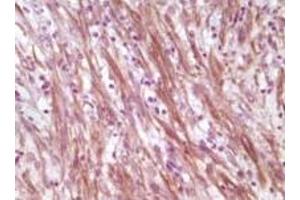 Immunohistochemistry (IHC) image for anti-Desmin (DES) (truncated) antibody (ABIN2464045)