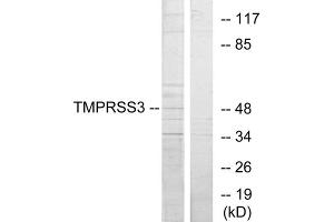 Western blot analysis of extracts from HUVEC cells, using TMPRSS3 antibody. (TMPRSS3 anticorps  (C-Term))