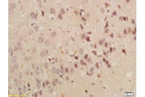 Formalin-fixed and paraffin embedded rat brain labeled with Anti-GRP78 Polyclonal Antibody, Unconjugated (ABIN673554) followed by conjugation to the secondary antibody and DAB staining (GRP78 anticorps  (AA 251-360))