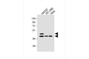 All lanes : Anti-SD3 Antibody at 1:1000 dilution Lane 1: HACAT whole cell lysate Lane 2: HT-1080 whole cell lysate Lane 3: Hela whole cell lysate Lysates/proteins at 20 μg per lane.