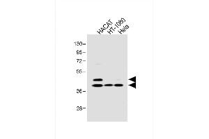 All lanes : Anti-SD3 Antibody at 1:1000 dilution Lane 1: HACAT whole cell lysate Lane 2: HT-1080 whole cell lysate Lane 3: Hela whole cell lysate Lysates/proteins at 20 μg per lane. (SMAD3 anticorps  (pSer213))
