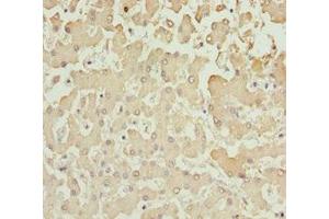Immunohistochemistry of paraffin-embedded human liver tissue using ABIN7143586 at dilution of 1:100 (AKR7A2 anticorps  (AA 100-359))