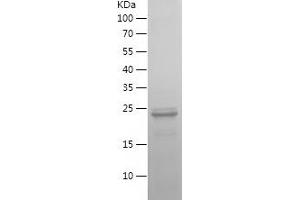 Western Blotting (WB) image for Interferon Regulatory Factor 5 (IRF5) (AA 1-200) protein (His tag) (ABIN7123497)