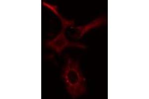 ABIN6277654 staining HeLa cells by IF/ICC. (MLKL anticorps  (Internal Region))