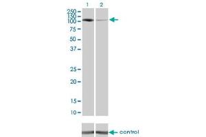 Western blot analysis of PKN1 over-expressed 293 cell line, cotransfected with PKN1 Validated Chimera RNAi (Lane 2) or non-transfected control (Lane 1).