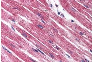 Immunohistochemistry (Formalin/PFA-fixed paraffin-embedded sections) of human heart tissue with EDNRA polyclonal antibody . (Endothelin-1 Receptor anticorps  (Extracellular Domain))
