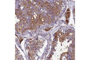 Immunohistochemical staining of human testis with SLC26A10 polyclonal antibody  shows strong cytoplasmic positivity in cells in seminiferus ducts and Leydig cells at 1:200-1:500 dilution. (SLC26A10 anticorps)