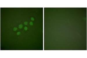 Immunofluorescence analysis of A549 cells, using SKP2/p45 Antibody. (SKP2 anticorps  (AA 366-415))