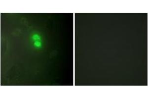 Immunofluorescence analysis of HeLa cells, using Dyskerin Antibody. (DKC1 anticorps  (AA 171-220))