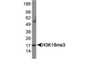 Western Blot of Rabbit Anti-Histone H3 [Trimethyl Lys18] Antibody.