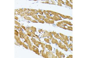 Immunohistochemistry of paraffin-embedded Rat brain using TR antibody (ABIN1683134, ABIN5664756, ABIN5664758 and ABIN6220605) at dilution of 1:100 (40x lens). (TRAP1 anticorps  (AA 445-704))