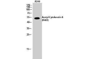 Western Blotting (WB) image for anti-Keratin 8 (KRT8) (acLys483) antibody (ABIN6285500) (KRT8 anticorps  (acLys483))