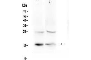 Western blot analysis of TSLP using anti-TSLP antibody . (Thymic Stromal Lymphopoietin anticorps)