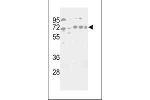 Western blot analysis of hG16L- 1817c in NIH-3T3, HepG2, Hela, Jurkat and NCI- cell line lysates (35 μg/lane). (ATG16L1 anticorps  (C-Term))