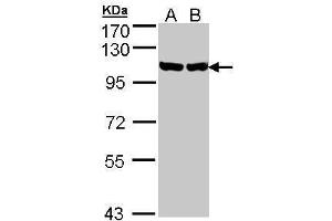 GRP94 anticorps  (Center)