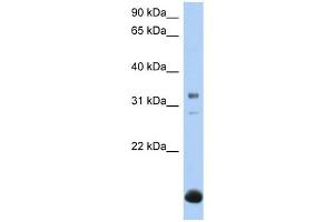 B3GALT6 antibody used at 1 ug/ml to detect target protein. (B3GALT6 anticorps  (N-Term))