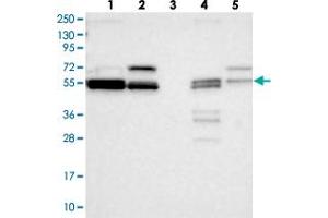 Western blot analysis of Lane 1: RT-4, Lane 2: U-251 MG, Lane 3: Human Plasma, Lane 4: Liver, Lane 5: Tonsil with LACTB polyclonal antibody  at 1:250-1:500 dilution. (LACTB anticorps)