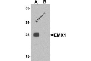 Western Blotting (WB) image for anti-Empty Spiracles Homeobox 1 (EMX1) (N-Term) antibody (ABIN1031368) (EMX1 anticorps  (N-Term))