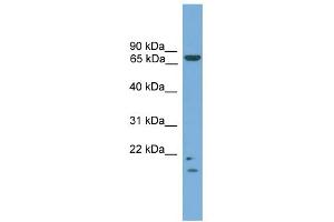 WB Suggested Anti-MRE11A Antibody Titration: 0. (Mre11 anticorps  (N-Term))