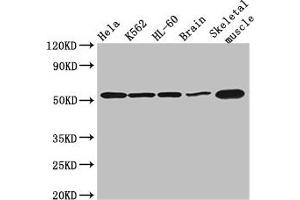 Western Blot Positive WB detected in: Hela whole cell lysate, K562 whole cell lysate, HL60 whole cell lysate, Mouse brain tissue, Mouse skeletal muscle tissue All lanes: ZBTB43 antibody at 3 μg/mL Secondary Goat polyclonal to rabbit IgG at 1/50000 dilution Predicted band size: 53 kDa Observed band size: 53 kDa (ZBTB43 anticorps  (AA 165-467))