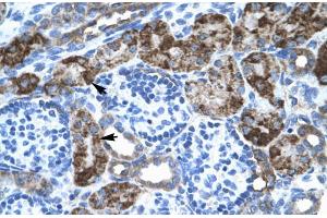 Rabbit Anti-EN2 Antibody  Paraffin Embedded Tissue: Human Kidney Cellular Data: Epithelial cells of renal tubule Antibody Concentration: 4.