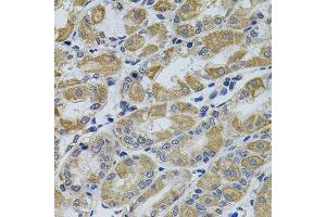 Immunohistochemistry of paraffin-embedded human stomach using PTK7 antibody.