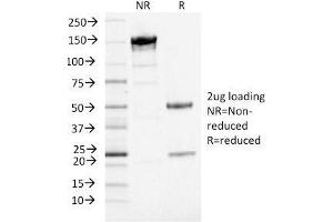 SDS-PAGE Analysis Purified PD-L1 Mouse Monoclonal Antibody (PDL1/2746) (unconjugated).