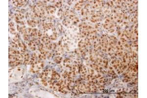Image no. 1 for anti-Nuclear Receptor Coactivator 4 (NCOA4) (AA 505-615) antibody (ABIN599025) (NCOA4 anticorps  (AA 505-615))