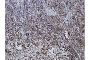 Immunoperoxidase of monoclonal antibody to STAT5B on formalin-fixed paraffin-embedded human lymph node.