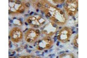 IHC-P analysis of kidney tissue, with DAB staining.