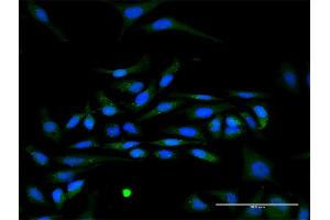 Immunofluorescence of purified MaxPab antibody to IFNA17 on HeLa cell. (IFNA17 anticorps  (AA 1-189))