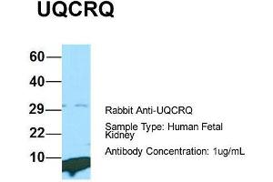 Host: Rabbit  Target Name: UQCRQ  Sample Tissue: Human Fetal Kidney  Antibody Dilution: 1. (UQCRQ anticorps  (Middle Region))