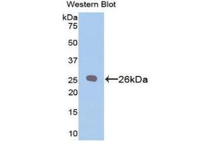 Western Blotting (WB) image for anti-B-Cell CLL/lymphoma 2 (BCL2) (AA 2-208) antibody (ABIN1858119) (Bcl-2 anticorps  (AA 2-208))