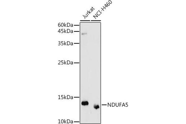 NDUFA5 Antikörper  (AA 1-116)