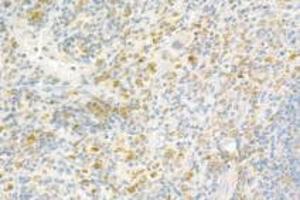 Immunohistochemistry analysis of paraffin-embedded rat spleen using,Resistin (ABIN7075402) at dilution of 1: 800 (Resistin anticorps)
