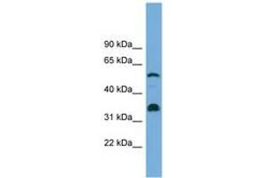 Image no. 1 for anti-Cytochrome P450, Family 26, Subfamily B, Polypeptide 1 (CYP26B1) (C-Term) antibody (ABIN6744176)