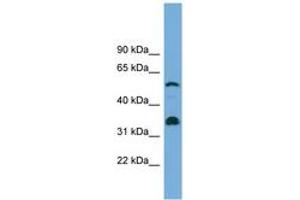 Image no. 1 for anti-Cytochrome P450, Family 26, Subfamily B, Polypeptide 1 (CYP26B1) (C-Term) antibody (ABIN6744176) (CYP26B1 anticorps  (C-Term))