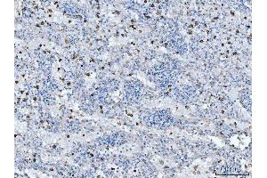 IHC analysis of CD14 using anti-CD14 antibody (ABIN7600531).