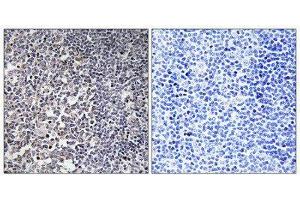 Immunohistochemistry (IHC) image for anti-Mitochondrial Ribosomal Protein S16 (MRPS16) (Internal Region) antibody (ABIN1850528) (MRPS16 anticorps  (Internal Region))