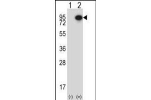 Western blot analysis of CTTN (arrow) using rabbit polyclonal CTTN Antibody (Center) (ABIN657649 and ABIN2846644).